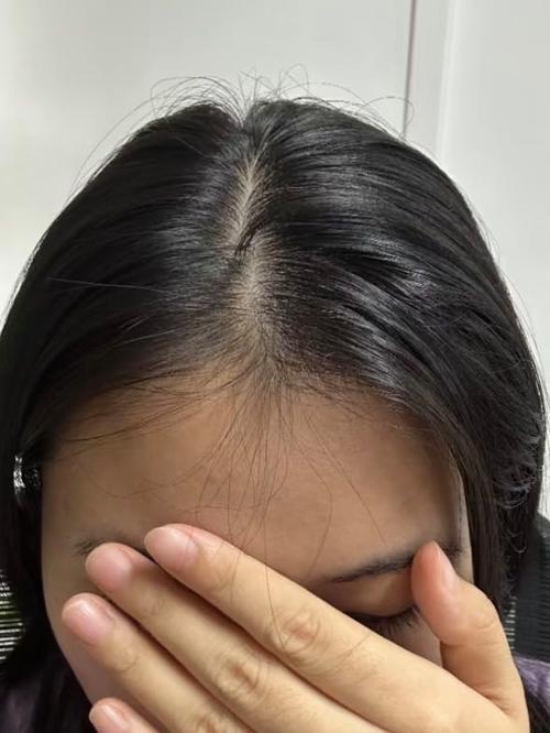 早稻田大学研发防秃头洗发水，试用者考过N1后集体过敏