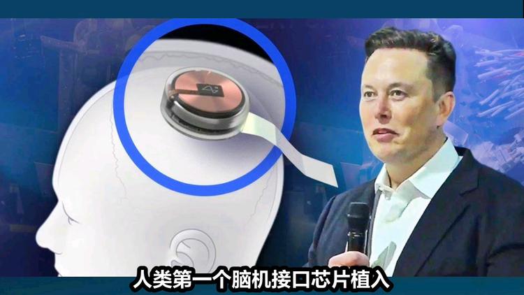 马斯克脑机接口公司获批人体试验，志愿者称"像被外星人控制"